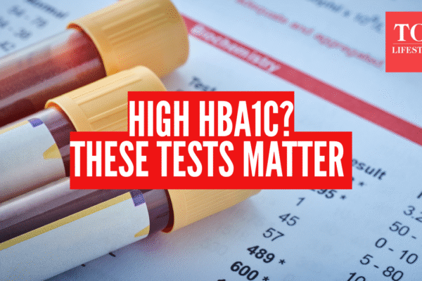 Msid 126125036imgsize 875078.cms .png