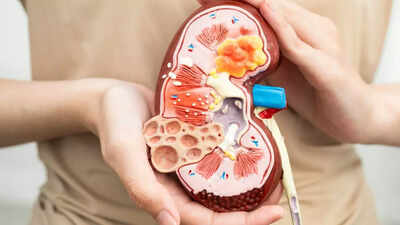 Reverse kidney damage naturally foods and habits for reducing inflammation and boosting metabolism.jpg