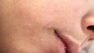 Understanding thyroid disorders how hypothyroidism and hyperthyroidism impact skin hair and nail health.jpg