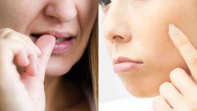 Why you cant stop picking your skin know what really causes it and how you can break the cycle.jpg