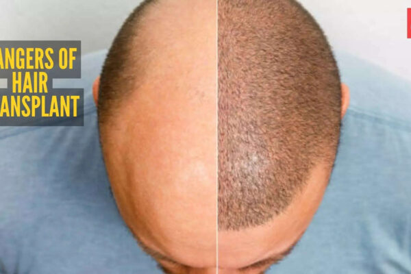 Msid 127256684imgsize 62228.cms .jpeg