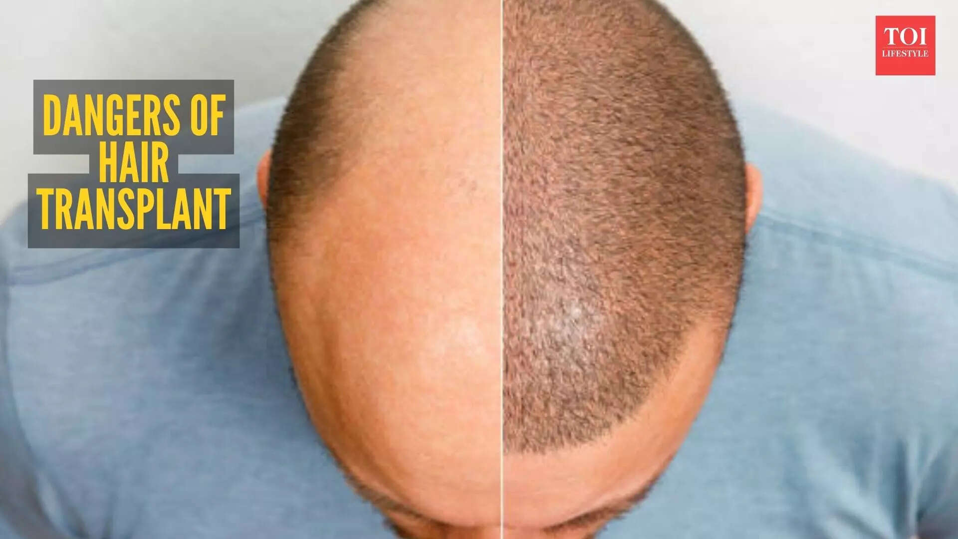 Msid 127256684imgsize 62228.cms .jpeg