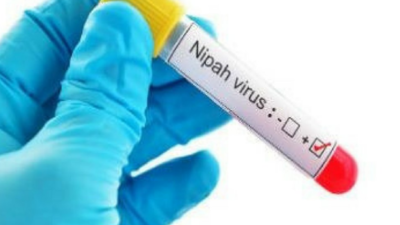 Nipah virus.jpg