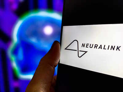 First human patient with elon musk39s neuralink brain chip noland arbaugh shares 100 days update.jpg