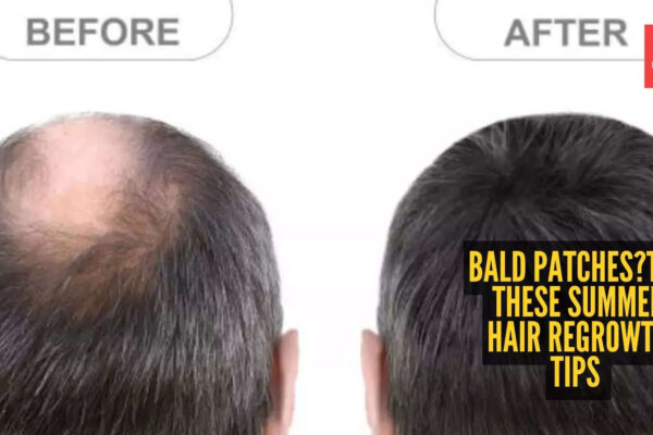 Msid 128958641imgsize 72966.cms .jpeg