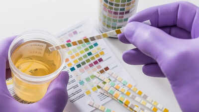Urine.jpg